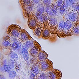 Immunohistochemistry alpha-Methylacyl-CoA Racemase/AMACR Antibody [Unconjugated]
