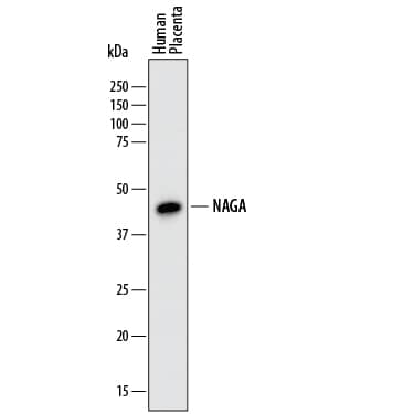 Western blot shows lysates of human placenta tissue. PVDF membrane was probed with 1 µg/mL of Sheep Anti-Human a-N-acetylgalactosaminidase/NAGA Antigen Affinity-purified Polyclonal Antibody (Catalog # AF6717) followed by HRP-conjugated Anti-Sheep IgG Secondary Antibody (Catalog # HAF016). A specific band was detected for a-N-acetylgalactosaminidase/NAGA at approximately 45 kDa (as indicated). This experiment was conducted under reducing conditions and using Immunoblot Buffer Group 1.