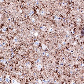 a-Synuclein was detected in immersion fixed paraffin-embedded sections of human brain (hippocampus) using Mouse Anti-Human a-Synuclein Monoclonal Antibody (Catalog # MAB13383) at 5 µg/mL for 1 hour at room temperature followed by incubation with the Anti-Mouse IgG VisUCyte™ HRP Polymer Antibody (Catalog # VC001). Tissue was stained using DAB (brown) and counterstained with hematoxylin (blue). Specific staining was localized to synaptic boutons. View our protocol for IHC Staining with VisUCyte HRP Polymer Detection Reagents.