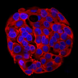 Immunocytochemistry alpha-Taxilin Antibody [Unconjugated]
