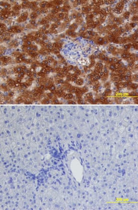 Immunohistochemistry alpha 1-Acid Glycoprotein Antibody (386131) [Unconjugated]