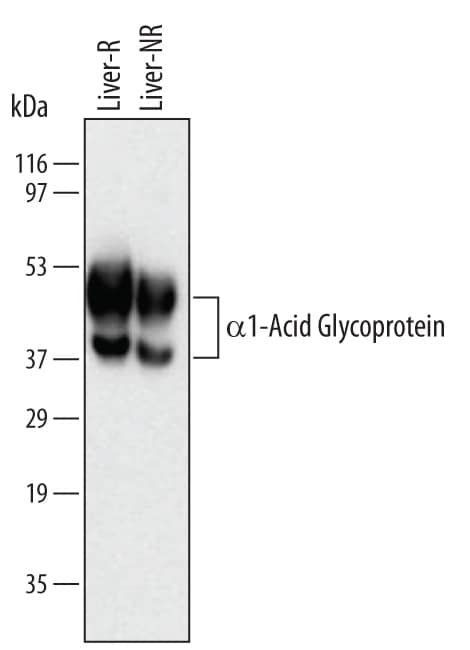 Western Blot alpha 1-Acid Glycoprotein Antibody (386131) [Unconjugated]