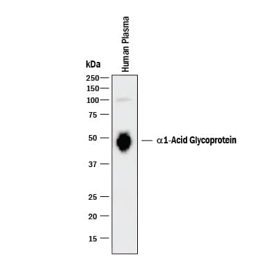 Western blot shows human plasma. PVDF membrane was probed with 0.1 µg/mL of Goat Anti-Human a1-Acid Glycoprotein Antigen Affinity-purified Polyclonal Antibody (Catalog # AF3694) followed by HRP-conjugated Anti-Goat IgG Secondary Antibody (Catalog # HAF017). A specific band was detected for a1-Acid Glycoprotein at approximately 45-50 kDa (as indicated). This experiment was conducted under reducing conditions and using Immunoblot Buffer Group 1.