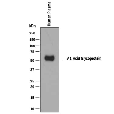 Western Blot alpha 1-Acid Glycoprotein Antibody (386131) [Unconjugated]