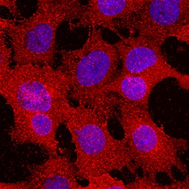 Immunocytochemistry alpha 1B-Glycoprotein Antibody [Unconjugated]