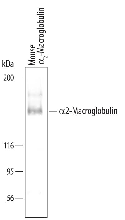 Western blot shows samples of purified a2-Macroglobulin from mouse sera. PVDF membrane was probed with 0.1 µg/mL Sheep Anti-Mouse a2-Macroglobulin Antigen Affinity-purified Polyclonal Antibody (Catalog # AF5798) followed by HRP-conjugated Anti-Sheep IgG Secondary Antibody (Catalog # HAF016). A specific band for a2-Macroglobulin was detected at approximately 180 kDa (as indicated). This experiment was conducted under reducing conditions and using Immunoblot Buffer Group 8.