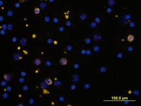 a2-Macroglobulin was detected in immersion fixed human peripheral blood mononuclear cells (PBMCs) using Goat Anti-Human a2-Macroglobulin Biotinylated Antigen Affinity-purified Poly-clonal Antibody (Catalog # BAF1938) at 10 µg/mL for 3 hours at room temperature. Cells were stained using the NorthernLights™ 557-conjugated Streptavidin (yellow; Catalog # NL999) and counter-stained with DAPI (blue). View our protocol for Fluorescent ICC Staining of Non-adherent Cells.