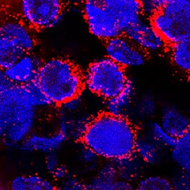Immunocytochemistry alpha 2-Macroglobulin Antibody [Unconjugated]