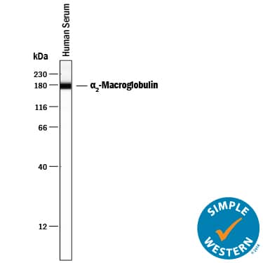 Simple Western alpha 2-Macroglobulin Antibody [Unconjugated]