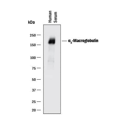 Western Blot alpha 2-Macroglobulin Antibody [Unconjugated]