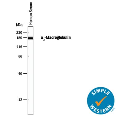 Simple Western alpha 2-Macroglobulin Antibody (257316) [Unconjugated]