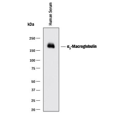 Western Blot alpha 2-Macroglobulin Antibody (257316) [Unconjugated]