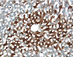 Immunohistochemistry alpha 2u-Globulin Antibody [Unconjugated]