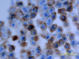 a2u-Globulin was detected in perfusion fixed frozen sections of rat liver using Mouse Anti-Rat a2u-Globulin Biotinylated Monoclonal Antibody (Catalog # BAM586) at 25 µg/mL overnight at 4 °C. Tissue was stained using the Anti-Mouse HRP-DAB Cell & Tissue Staining Kit (brown; Catalog # CTS002) and counter-stained with hematoxylin (blue). View our protocol for Chromogenic IHC Staining of Frozen Tissue Sections.