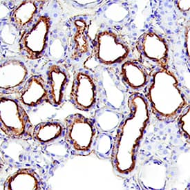 Immunohistochemistry alpha 2u-Globulin Antibody (129736) [Unconjugated]