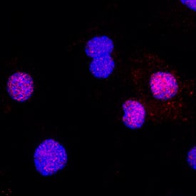 Alpha Actinin 2 was detected in immersion fixed C2C12 mouse myoblast cell line using Rabbit Anti-Human/Mouse/Rat alpha Actinin 2 Monoclonal Antibody (Catalog # MAB9830) at 3 µg/mL for 3 hours at room temperature. Cells were stained using the NorthernLights™ 557-conjugated Anti-Rabbit IgG Secondary Antibody (red; NL004) and counterstained with DAPI (blue). Specific staining was localized to cytoplasm and nuclei. View our protocol for Fluorescent ICC Staining of Cells on Coverslips.