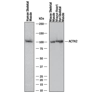 Western blot shows lysates of human skeletal muscle tissue, mouse skeletal muscle tissue, mouse heart tissue, and rat skeletal muslce tissue. PVDF membrane was probed with 0.2 µg/mL of Rabbit Anti-Human/Mouse/Rat alpha Actinin 2 Monoclonal Antibody (Catalog # MAB9830) followed by HRP-conjugated Anti-Rabbit IgG Secondary Antibody (HAF008). A specific band was detected for alpha Actinin 2 at approximately 100 kDa (as indicated). This experiment was conducted under reducing conditions and using Immunoblot Buffer Group 1.