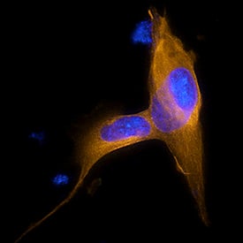 a Tubulin was detected in immersion fixed SH-SY5Y human neuroblastoma cell line using Mouse Anti-Human/Mouse/Rat a Tubulin Monoclonal Antibody (Catalog # MAB9344) at 8 µg/mL for 3 hours at room temperature. Cells were stained using the NorthernLights™ 557-conjugated Anti-Mouse IgG Secondary Antibody (yellow; Catalog # NL007) and counterstained with DAPI (blue). Specific staining was localized to cytoplasm. View our protocol for Fluorescent ICC Staining of Cells on Coverslips.