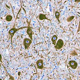 a Tubulin was detected in immersion fixed paraffin-embedded sections of human brain using Mouse Anti-Human/Mouse/Rat a Tubulin Monoclonal Antibody (Catalog # MAB9344) at 5 µg/mL for 1 hour at room temperature followed by incubation with the Anti-Mouse IgG VisUCyte™ HRP Polymer Antibody (Catalog # VC001). Tissue was stained using DAB (brown) and counterstained with hematoxylin (blue). Specific staining was localized to neuronal cytoplasm. View our protocol for IHC Staining with VisUCyte HRP Polymer Detection Reagents.