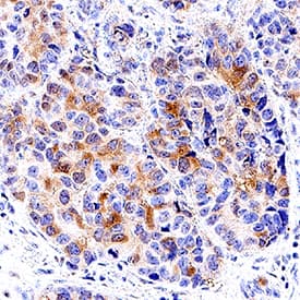 p21/CIP1/CDKN1A was detected in immersion fixed paraffin-embedded sections of human breast using Goat Anti-Human p21/CIP1/CDKN1A Biotinylated Antigen Affinity-purified Polyclonal Antibody (Catalog # BAF1047) at 5 µg/mL for 1 hour at room temperature followed by incubation with the Anti-Goat IgG VisUCyte™ HRP Polymer Antibody (VC004). Before incubation with the primary antibody, tissue was subjected to heat-induced epitope retrieval using Antigen Retrieval Reagent-Basic (CTS013). Tissue was stained using DAB (brown) and counterstained with hematoxylin (blue). Specific staining was localized to cytoplasm in ductal epithelial cells. Staining was performed using our protocol for IHC Staining with VisUCyte HRP Polymer Detection Reagents.