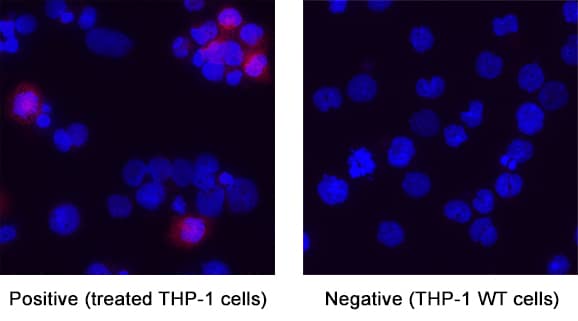IL‑1 beta /IL‑1F2 was detected in immersion fixed THP‑1 human acute monocytic leukemia cell line using Goat Anti-Human IL‑1 beta /IL‑1F2 Biotinylated Antigen Affinity-purified Polyclonal Antibody (Catalog # BAF201) at 5 µg/ml for 3 hours at room temperature. Cells were stained using the NorthernLights&trade; 557-conjugated Streptavidin (red; Catalog # NL999) and counterstained with DAPI (blue). Specific staining was localized to the cytoplasm of THP-1 cells treated with 200nM PMA for 24 hours then 10ug/mL LPS for 24 hours. View our protocol for Fluorescent ICC Staining of Cells on Coverslips.