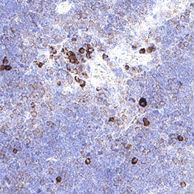 Limitin/IFN‑ zeta  was detected in immersion fixed paraffin-embedded sections of mouse thymus using Goat Anti-Mouse Limitin/IFN‑ zeta  Biotinylated Antigen Affinity-purified Polyclonal Antibody (Catalog # BAF597) at 3 µg/ml for 1 hour at room temperature followed by incubation with the Anti-Goat IgG VisUCyte™ HRP Polymer Antibody (Catalog # VC004) or the HRP-conjugated Anti-Goat IgG Secondary Antibody (Catalog # HAF017). Before incubation with the primary antibody, tissue was subjected to heat-induced epitope retrieval using VisUCyte Antigen Retrieval Reagent-Basic (Catalog # VCTS021). Tissue was stained using DAB (brown) and counterstained with hematoxylin (blue). Specific staining was localized to the cytoplasm and B cells. View our protocol for Chromogenic IHC Staining of Paraffin-embedded Tissue Sections.