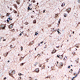 Cathepsin B was detected in immersion fixed paraffin-embedded sections of human brain cortex using Goat Anti-Human Cathepsin B Biotinylated Antigen Affinity-purified Polyclonal Antibody (Catalog # BAF953) at 15 µg/ml for 1 hour at room temperature followed by incubation with the Streptavidin-HRP (Catalog # DY998). Before incubation with the primary antibody, tissue was subjected to heat-induced epitope retrieval using VisUCyte Antigen Retrieval Reagent-Basic (Catalog # VCTS021). Tissue was stained using DAB (brown) and counterstained with hematoxylin (blue). Specific staining was localized to the cytoplasm. View our protocol for Chromogenic IHC Staining of Paraffin-embedded Tissue Sections.
