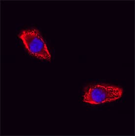Immunocytochemistry ICAM-1/CD54 Antibody (BBIG-I1) [Unconjugated]