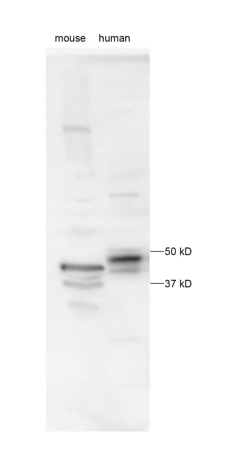 Western Blot: Rabbit Polyclonal PINK1 Antibody [BC100-494] - PINK1 detection in mouse and postmortem human cortex samples. 1:1000 dilution at 4 degrees overnight to detect endogenous PINK1 from mouse and postmortem human cortex samples (10 ug total protein). Image from a verified customer review.