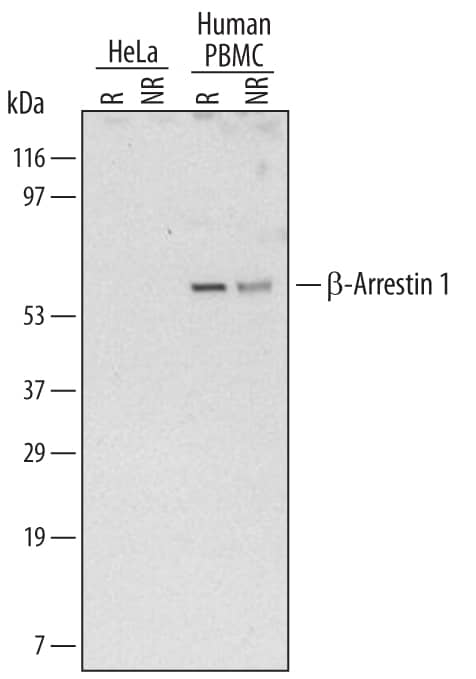 Western Blot beta-Arrestin 1 Antibody (425817)