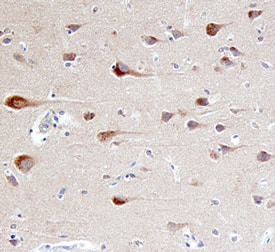  beta ‑Arrestin 2 was detected in immersion fixed paraffin-embedded sections of human brain (cortex) using 10 &micro;g/mL Human  beta ‑Arrestin 2 Antigen Affinity-purified Polyclonal Antibody (Catalog # AF4564) overnight at 4 &deg;C. Before incubation with the primary antibody tissue was subjected to heat-induced epitope retrieval using Antigen Retrieval Reagent-Basic (Catalog # CTS013). Tissue was stained with the Anti-Goat HRP-DAB Cell & Tissue Staining Kit (brown; Catalog # CTS008) and counterstained with hematoxylin (blue). View our protocol for Chromogenic IHC Staining of Paraffin-embedded Tissue Sections.