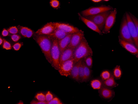  beta -Catenin was detected in immersion fixed SW480 human colorectal adenocarcinoma cell line using 10 µg/mL Mouse Anti-Human  beta -Catenin Monoclonal Antibody (Catalog # MAB13291) for 3 hours at room temperature. Cells were stained with the NorthernLights™ 557-conjugated Anti-Mouse IgG Secondary Antibody (red; Catalog # NL007) and counter-stained with DAPI (blue). View our protocol for Fluorescent ICC Staining of Cells on Coverslips.
