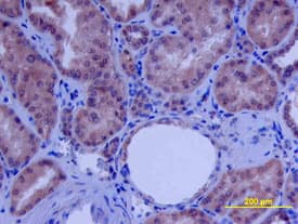 Immunohistochemistry beta-Defensin 4/2 Antibody