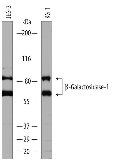 Western Blot beta-Galactosidase-1/GLB1 Antibody [Unconjugated]