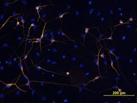  beta -III Tubulin was detected in immersion fixed 7 day differentiated rat cortical stem cells using Neuron-specific  beta -III Tubulin Biotinylated Monoclonal Antibody (Catalog # BAM1195) at 10 µg/mL for 3 hours at room temperature. Cells were stained using the NorthernLights™ 557-conjugated Streptavidin (yellow; Catalog # NL999) and counter-stained with DAPI (blue). View our protocol for Fluorescent ICC Staining of Cells on Coverslips.