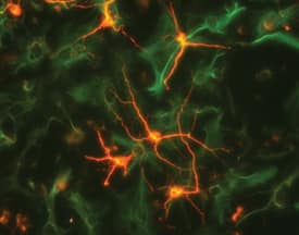  beta -III Tubulin was detected in rat cortical neurons using 5 µg/mL neuron-specific Mouse Anti-Neuron-specific  beta -III Tubulin Monoclonal Antibody (Catalog # MAB1195). GFAP was detected in rat astrocytes using 10 µg/mL Human GFAP Antigen Affinity-purified Polyclonal Antibody (AF2594). Cells were incubated with primary antibodies for 3 hours at room temperature. Cells were stained for beta-III Tubulin using the NorthernLights™ 557-conjugated Anti-Mouse IgG Secondary Antibody (red; NL007) and for GFAP using the NorthernLights 493-conjugated Anti-Sheep IgG Secondary Antibody (green; NL012). View our protocol for Fluorescent ICC Staining of Cells on Coverslips.