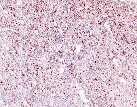  beta -NGF was detected in perfusion fixed frozen sections of rat brain using Rat  beta -NGF Antigen Affinity-purified Polyclonal Antibody (Catalog # AF-556-NA) at 15 &micro;g/mL overnight at 4 &deg;C. Tissue was stained using the Anti-Goat HRP-AEC Cell & Tissue Staining Kit (red; Catalog # CTS009) and counterstained with hematoxylin (blue). View our protocol for Chromogenic IHC Staining of Frozen Tissue Sections.
