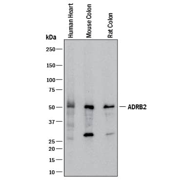 Western Blot beta-2 Adrenergic R/ADRB2 Antibody (2204C) [Unconjugated]