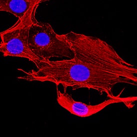  beta -Actin was detected in immersion fixed NIH-3T3 mouse embryonic fibroblast cell line using Mouse Anti-Human/Mouse/Rat  beta -Actin Monoclonal Antibody (Catalog # MAB8929) at 0.1 µg/mL for 3 hours at room temperature. Cells were stained using the NorthernLights™ 557-conjugated Anti-Mouse IgG Secondary Antibody (red; Catalog # NL007) and counterstained with DAPI (blue). Cells were fixated in methanol. Specific staining was localized to cytoskeleton.