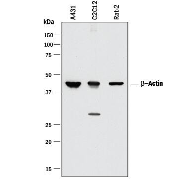 Western blot shows lysates of A431 human epithelial carcinoma cell line, C2C12 mouse myoblast cell line, and Rat-2 rat embryonic fibroblast cell line. PVDF membrane was probed with 0.01 µg/mL of Mouse Anti-Human/Mouse/Rat  beta -Actin Monoclonal Antibody (Catalog # MAB8929) followed by HRP-conjugated Anti-Mouse IgG Secondary Antibody (Catalog # HAF018). A specific band was detected for  beta -Actin at approximately 45 kDa (as indicated). This experiment was conducted under reducing conditions and using Immunoblot Buffer Group 1.