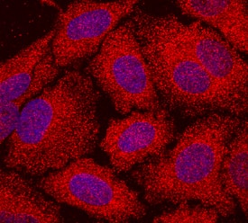  beta -Actin was detected in immersion fixed HeLa human cervical epithelial carcinoma cell line using Mouse Anti-Human  beta -Actin Monoclonal Antibody (Catalog # MAB8969) at 10 µg/mL for 3 hours at room temperature. Cells were stained using the NorthernLights™ 557-conjugated Anti-Mouse IgG Secondary Antibody (red; Catalog # NL007) and counterstained with DAPI (blue). Specific staining was localized to cytoplasm. View our protocol for Fluorescent ICC Staining of Cells on Coverslips.