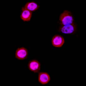  beta -Catenin was detected in immersion fixed SW480 human colorectal adenocarcinoma cell line using Goat Anti-Human/Mouse/Rat  beta -Catenin Antigen Affinity-purified Polyclonal Antibody (Catalog # AF1329) at 15 µg/mL for 3 hours at room temperature. Cells were stained using the NorthernLights™ 557-conjugated Anti-Goat IgG Secondary Antibody (red; Catalog # NL001) and counterstained with DAPI (blue). Specific staining was localized to cytoplasm and nuclei. View our protocol for Fluorescent ICC Staining of Cells on Coverslips.