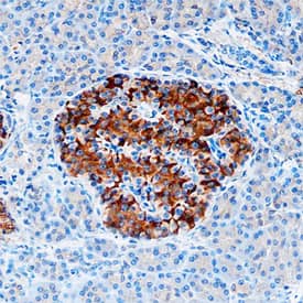  beta -Catenin was detected in immersion fixed paraffin-embedded sections of human pancreas using Mouse Anti-Human  beta -Catenin Monoclonal Antibody (Catalog # MAB13291) at 1.7 µg/mL overnight at 4 °C. Tissue was stained using the Anti-Mouse HRP-DAB Cell & Tissue Staining Kit (brown; Catalog # CTS002) and counterstained with hematoxylin (blue). Specific staining was localized to plasma membranes. View our protocol for Chromogenic IHC Staining of Paraffin-embedded Tissue Sections.
