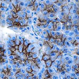  beta -Catenin was detected in immersion fixed paraffin-embedded sections of human pancreas using Mouse Anti-Human/Mouse/Rat  beta -Catenin Monoclonal Antibody (Catalog # MAB1329) at 1.7 µg/mL overnight at 4 °C. Tissue was stained using the Anti-Mouse HRP-DAB Cell & Tissue Staining Kit (brown; Catalog # CTS002) and counter-stained with hematoxylin (blue). Specific staining was localized to plasma membranes. View our protocol for Chromogenic IHC Staining of Paraffin-embedded Tissue Sections.