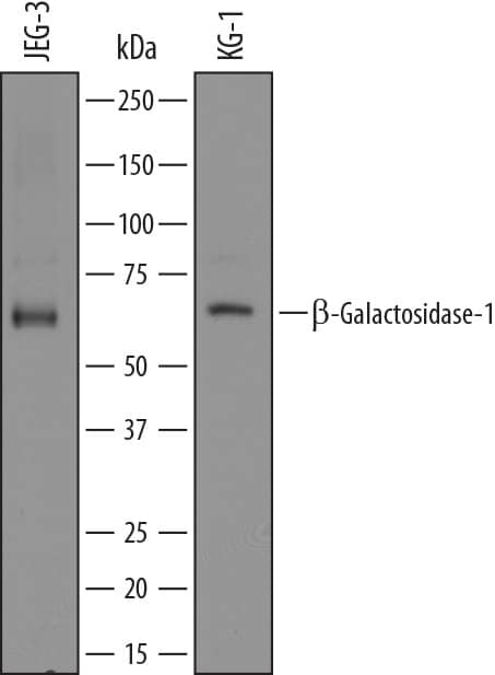 Western Blot beta-Galactosidase-1/GLB1 Antibody (810226) [Unconjugated]