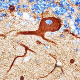  beta -III Tubulin was detected in immersion fixed paraffin-embedded sections of human brain (cerebellum) using Mouse Anti-Neuron-specific  beta -III Tubulin Monoclonal Antibody (Catalog # MAB1195) at 8 µg/mL for 1 hour at room temperature followed by incubation with the Anti-Mouse IgG VisUCyte™ HRP Polymer Antibody (VC001). Tissue was stained using DAB (brown) and counterstained with hematoxylin (blue). Specific staining was localized to Purkinje neurons. View our protocol for IHC Staining with VisUCyte HRP Polymer Detection Reagents.