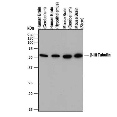 Western blot shows lysates of human brain (cerebellum) tissue, human brain (hypothalamus) tissue, mouse brain (cerebellum) tissue, and mouse brain (stem) tissue. PVDF membrane was probed with 0.2 µg/mL of Mouse Anti-Neuron-specific  beta -III Tubulin Monoclonal Antibody (Catalog # MAB1195) followed by HRP-conjugated Anti-Mouse IgG Secondary Antibody (HAF018). A specific band was detected for  beta -III Tubulin at approximately 55 kDa (as indicated). This experiment was conducted under reducing conditions and using Immunoblot Buffer Group 1.