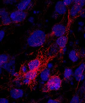 beta -I Tubulin was detected in immersion fixed BG01V human embryonic stem cells differentiated into cardiomyocytes using Mouse Anti-Human  beta -I Tubulin Monoclonal Antibody (Catalog # MAB8527) at 10 µg/mL for 3 hours at room temperature. Cells were stained using the NorthernLights™ 557-conjugated Anti-Goat IgG Secondary Antibody (red; Catalog # NL001) and counterstained with DAPI (blue). Specific staining was localized to cytoplasm and cytoskeleton. View our protocol for Fluorescent ICC Staining of Cells on Coverslips.