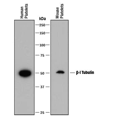 Western blot shows lysates of human platelets and mouse platelets. PVDF membrane was probed with 0.2 µg/mL of Mouse Anti-Human  beta -I Tubulin Monoclonal Antibody (Catalog # MAB8527) followed by HRP-conjugated Anti-Mouse IgG Secondary Antibody (Catalog # HAF018). A specific band was detected for  beta -I Tubulin at approximately 50 kDa (as indicated). This experiment was conducted under reducing conditions and using Immunoblot Buffer Group 1.