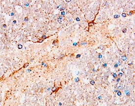  beta -NGF was detected in immersion fixed paraffin-embedded sections of human brain using Goat Anti-Human  beta -NGF Antigen Affinity-purified Polyclonal Antibody (Catalog # AF-256-NA) at 10 µg/mL overnight at 4 °C. Tissue was stained using the Anti-Goat HRP-DAB Cell & Tissue Staining Kit (brown; Catalog # CTS008) and counterstained with hematoxylin (blue). Specific staining was localized to axons. View our protocol for Chromogenic IHC Staining of Paraffin-embedded Tissue Sections.